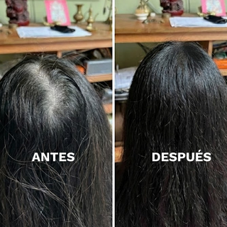 Básicos Anticaída: Shampoo Anticaída + Agua de Romero