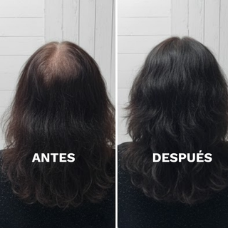 Pack Shampoo + Acondicionador